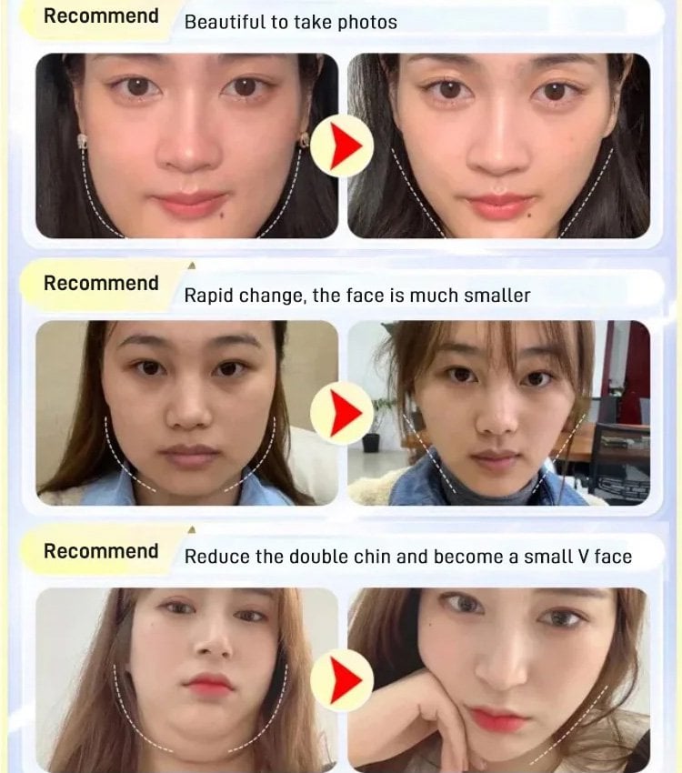 1+1 Gratis | VLift™ Definieren Sie Ihre Kinnlinie über Nacht neu!