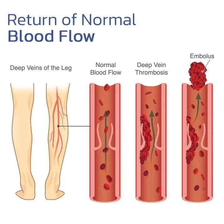 Self-heating ™ | Kniebandage: schnelle Linderung von Schmerzen