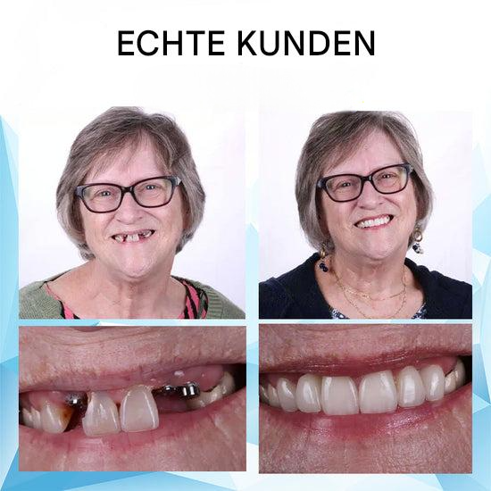 DentaFlex™ - Hilft Ihnen, das natürliche Aussehen und Gefühl Ihres Lächelns mit professionellen Ergebnissen wiederzuerlangen