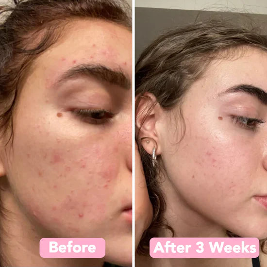 2+2 GRATIS | BrightEase™ – Enthülle strahlende, gleichmäßige Haut, die Blicke auf sich zieht