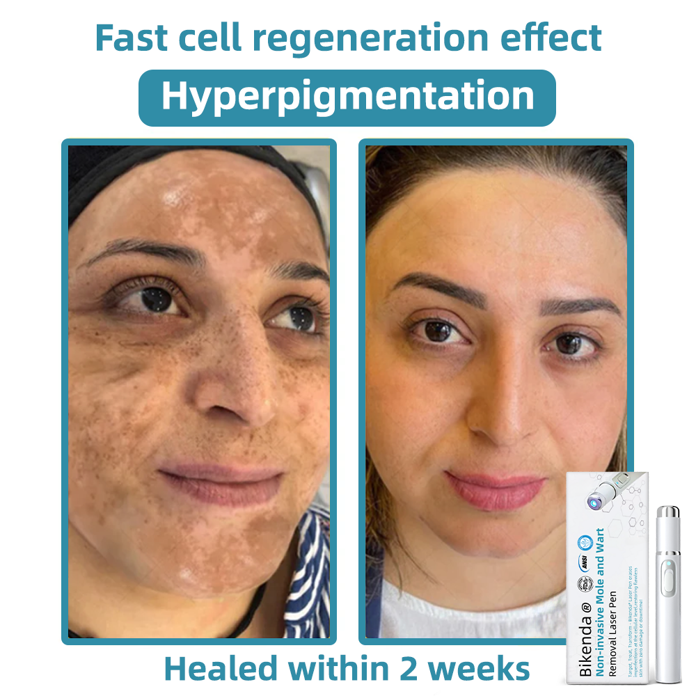 LumiRaze™ — Entfernt schnell Hautunreinheiten und entfaltet strahlendes Selbstvertrauen