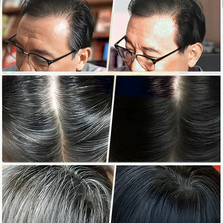 1 + 1 GRATIS HEUTE | NatureGlow™ | Haarfarbe Essenz