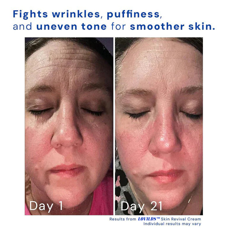 1+1 Gratis | Skin Revival Cream™ Glättet Unreinheiten