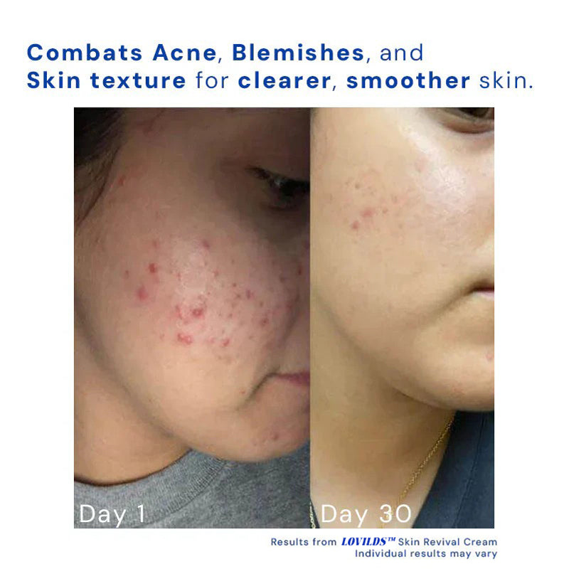 1+1 Gratis | Skin Revival Cream™ Glättet Unreinheiten