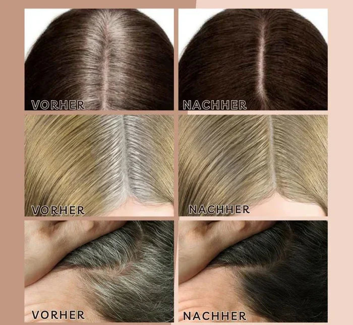 BeautyBlend™ - Erzielen Sie makellose Haaransatzübergänge in Sekundenschnelle