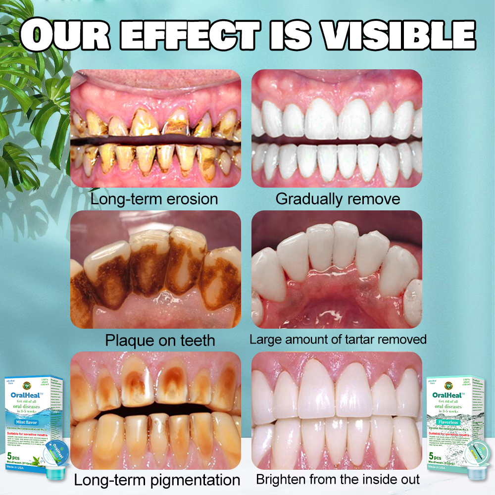 Jelly Cup Mundspülung