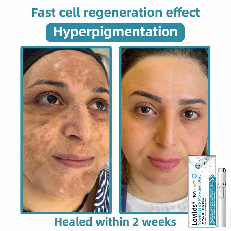 LumaClear™ — Enthülle makellose, strahlende Haut, die du gerne zeigen wirst