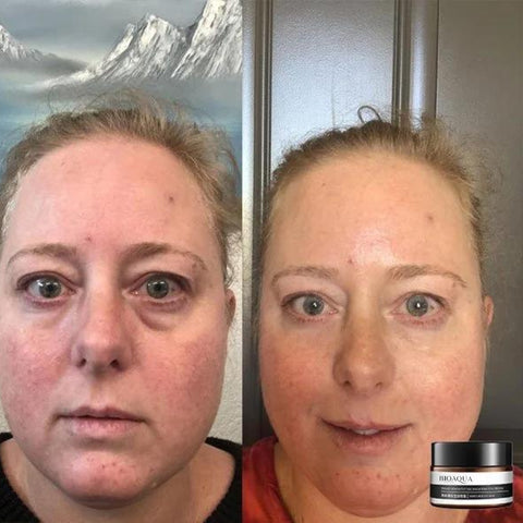 1+1 GRATIS | EverYouth™ Entdecken Sie heute die Quelle der Verjüngung!