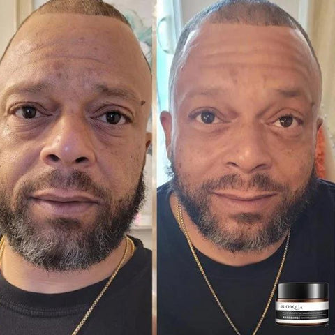 1+1 GRATIS | EverYouth™ Entdecken Sie heute die Quelle der Verjüngung!