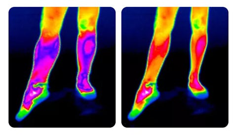 Self-heating ™ | Kniebandage: schnelle Linderung von Schmerzen