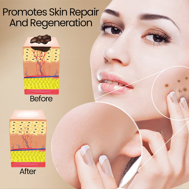 1+1 GRATIS | BeeClear™ Enthülle deine strahlende Haut, verabschiede dich von Hautproblemen!