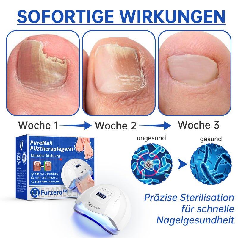 NailCure™ - Nagelpilz-Laserbehandlung Lösung (50% RABATT)