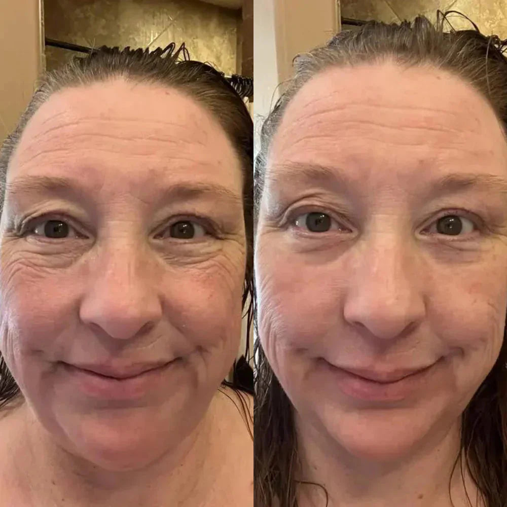 1+1 Gratis | Sofortige Lifting-Creme™ - Die Anti-Aging-Revolution für sofort straffere Haut!