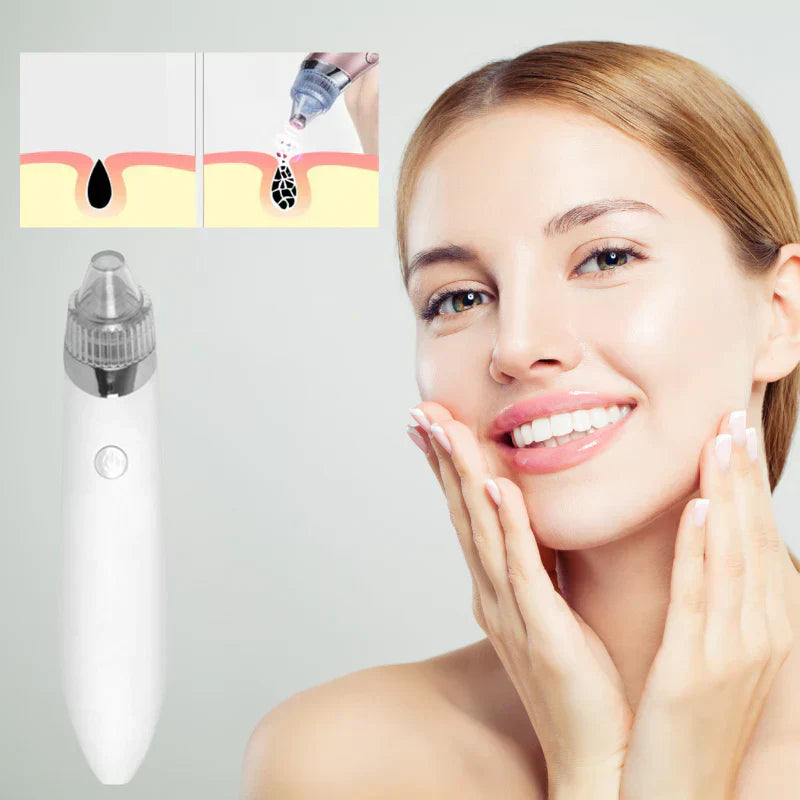 PoreCleaner™ | Für sichtbar reinere Haut in nur wenigen Minuten!