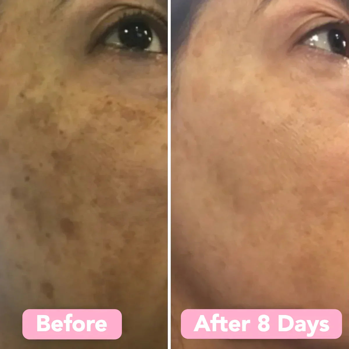 2+2 GRATIS | BrightEase™ – Enthülle strahlende, gleichmäßige Haut, die Blicke auf sich zieht