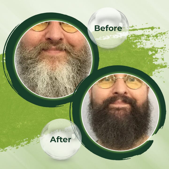 Supreme HairRenew™ 1+1 Frei! Handgemachtes Haarverdunkelungs-Shampoo