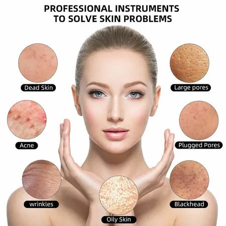 SkinRelief™ - Effektive Hautstraffung