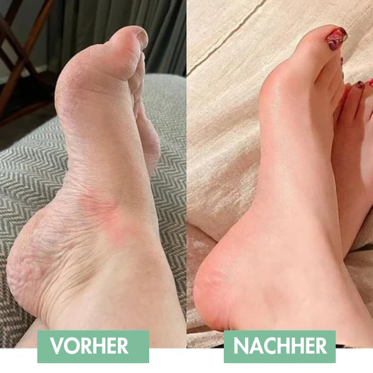 SoleVibe™ — Schmerzen in den Füßen lindern und jeden Schritt neu beleben