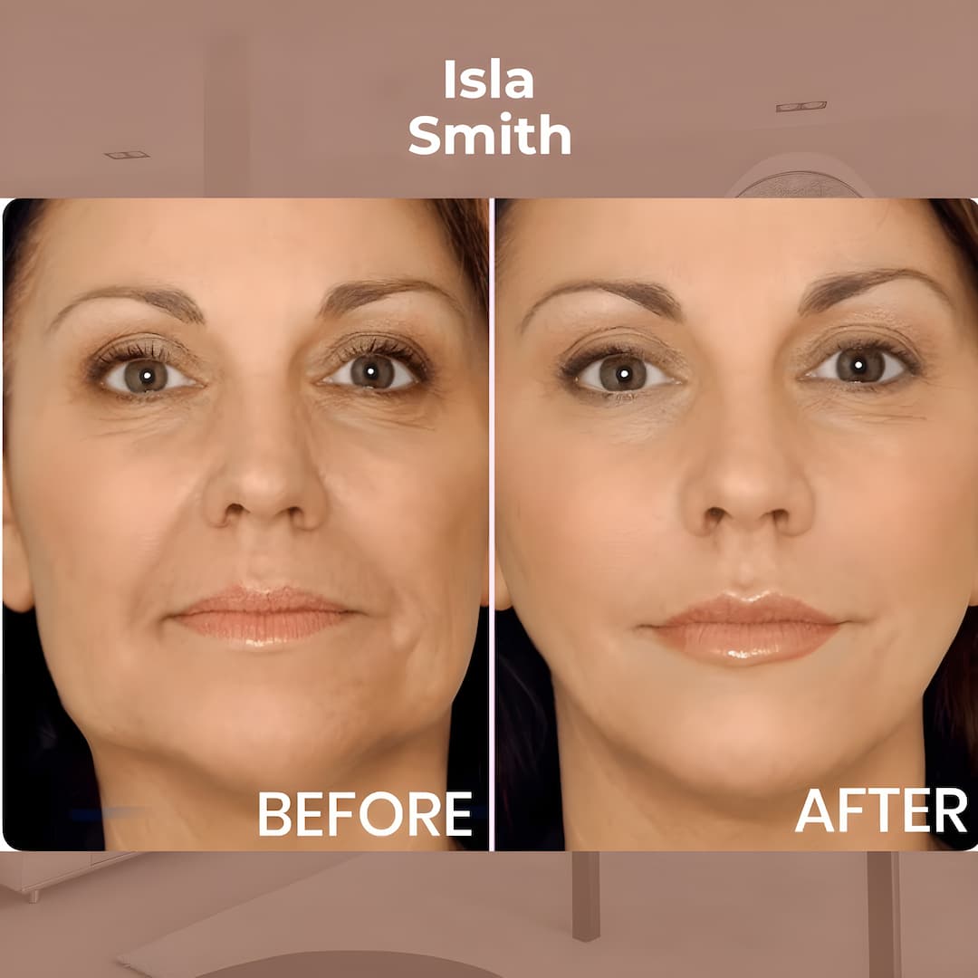 LiftEase™ - Unsichtbare, straffende Behandlung!