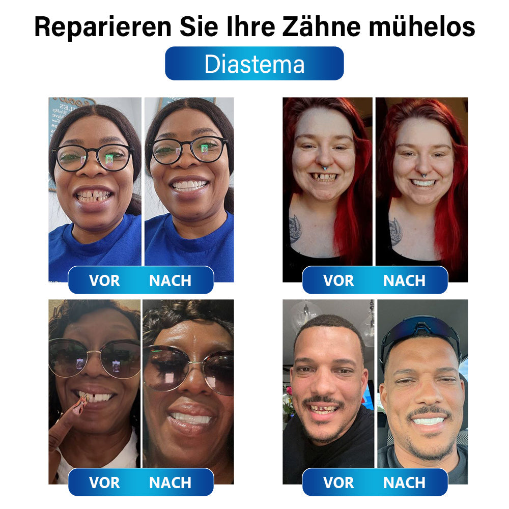 ZahnFix | LED-Härtungslampe für schnelle Zahnreparatur und Zahnersatzgel