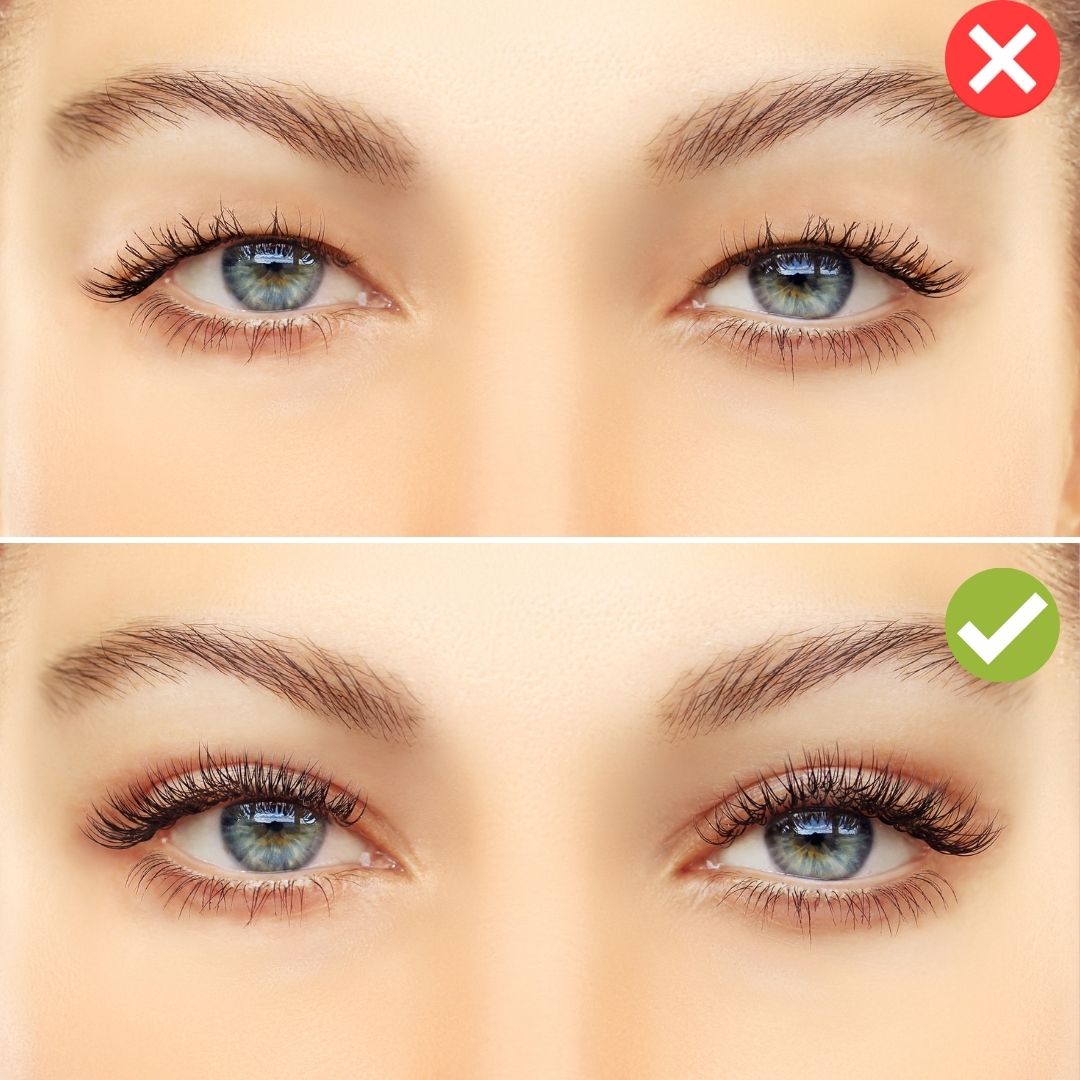 Brightie™ - Unsichtbare Lidstraffungsstreifen Kit | 1+1 Gratis