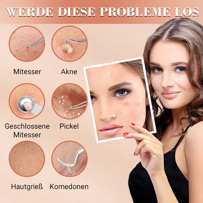 DermaTool™ – Präzise Entfernung von Mitessern