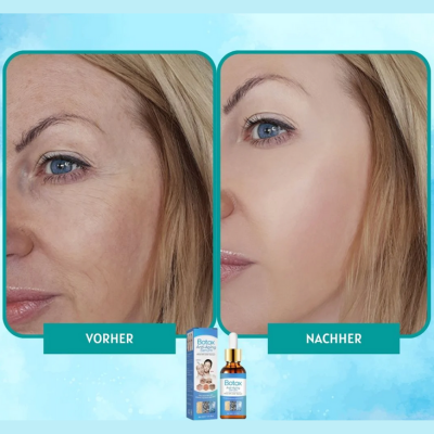 1+1 Gratis | YouthGlow™ Botox-freies Anti-Aging-Serum