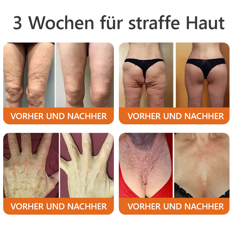 1+1 Gratis | Skinova™ Die natürliche Lösung für alltägliche Hautirritationen