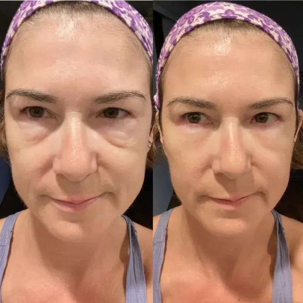 1+1 Gratis | Sofortige Lifting-Creme™ - Die Anti-Aging-Revolution für sofort straffere Haut!