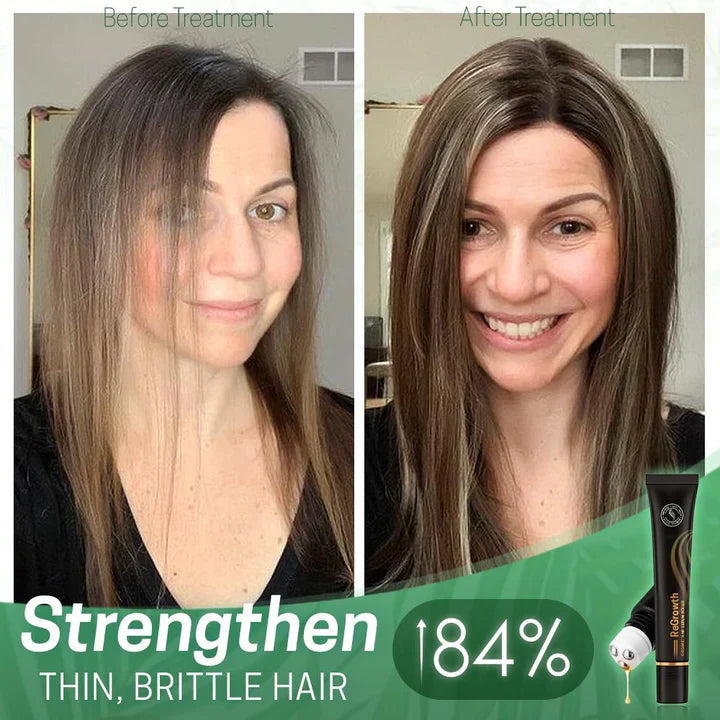 1+1 Gratis | StrandSavior™ Verhindert kahle Stellen