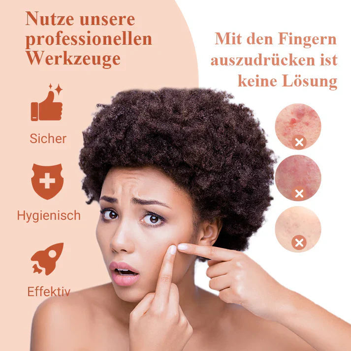 DermaTool™ – Präzise Entfernung von Mitessern