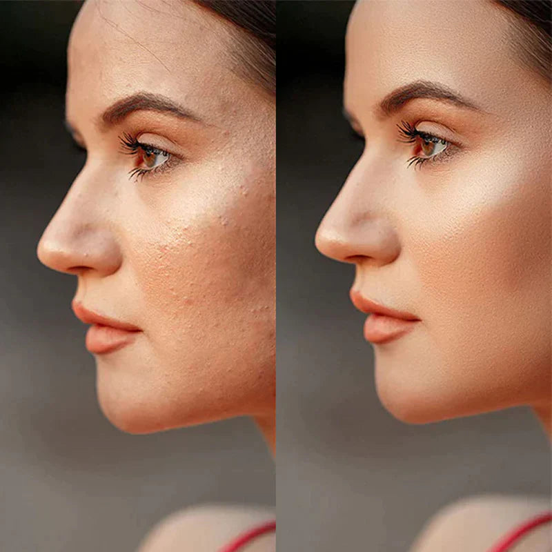 HautRevital - Sofort straffende und glättende Hautpflege | 1+1 GRATIS