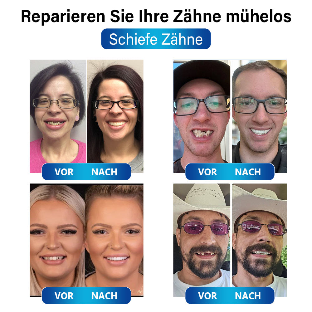 ZahnFix | LED-Härtungslampe für schnelle Zahnreparatur und Zahnersatzgel