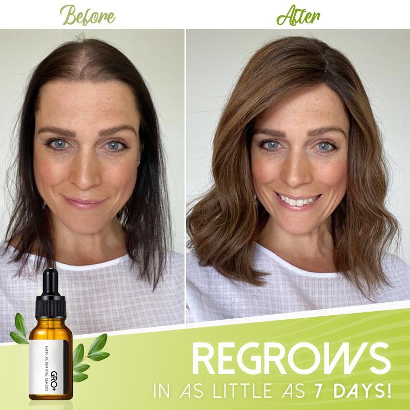 GRO+ HAIR SERUM™ | VOLLERES HAAR ERHALTEN