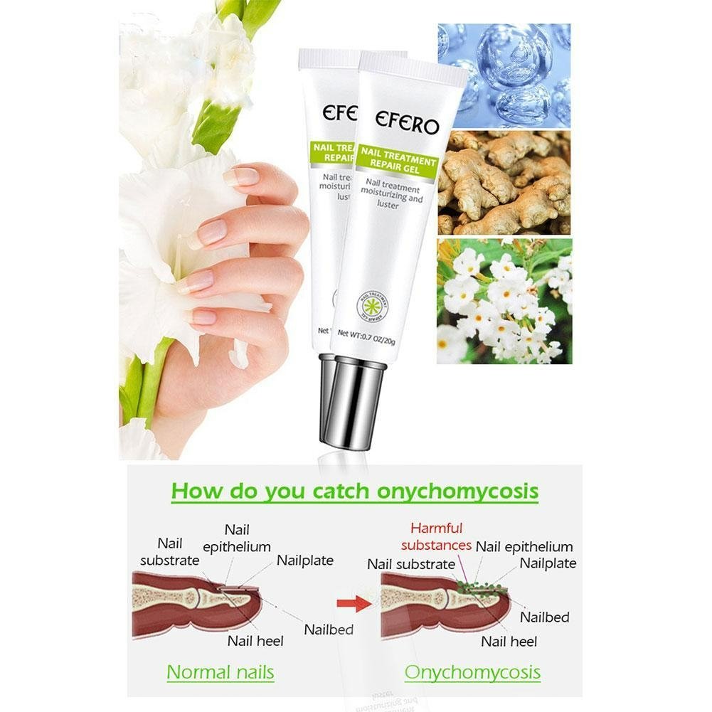 Nail Repair Gel | Anti-Schimmel & Verkleuring | Herstelt & Hydrateert | 1+1 Gratis