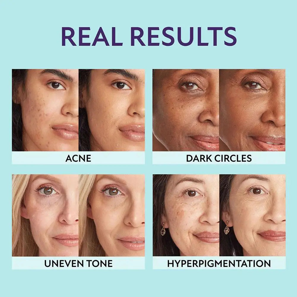 1+1 Gratis | Supreme Cream CoverMax™ — Enthülle strahlende, makellose Haut, die den ganzen Tag hydriert und geschützt bleibt