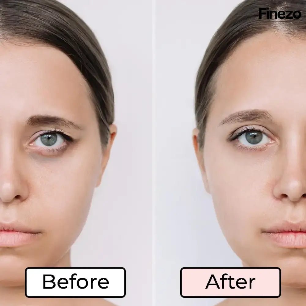 LumiVive™ – Wach auf mit sofort helleren, jünger aussehenden Augen