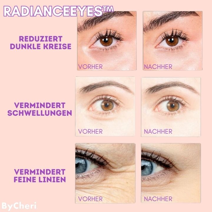 50% RABATT TEMPORÄR | RadianceEyes™ | Erleben Sie Augenmassage jederzeit und überall!