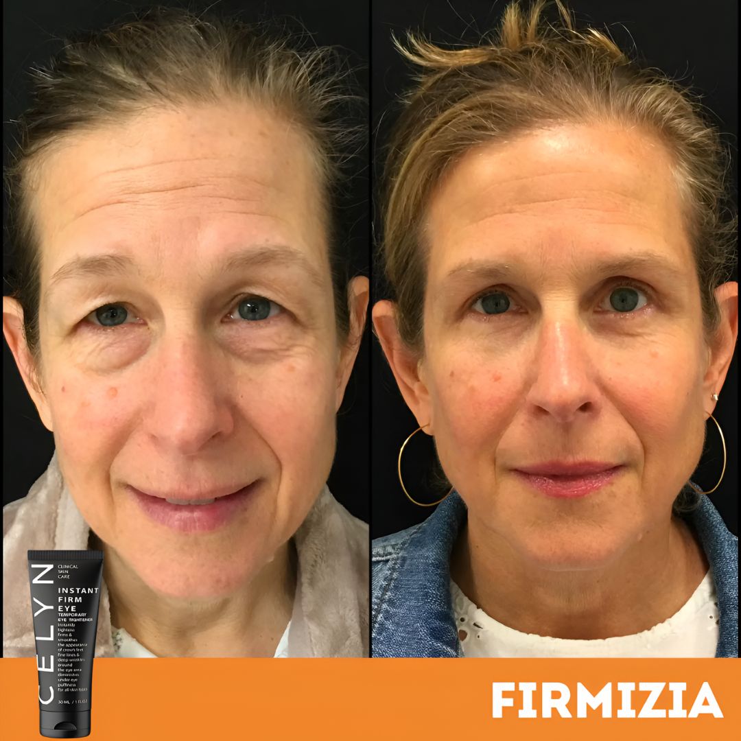 Firmizia™ - Sofortige Anti-Falten und Augenringe-Creme