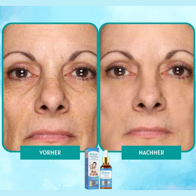 1+1 Gratis | YouthGlow™ Botox-freies Anti-Aging-Serum