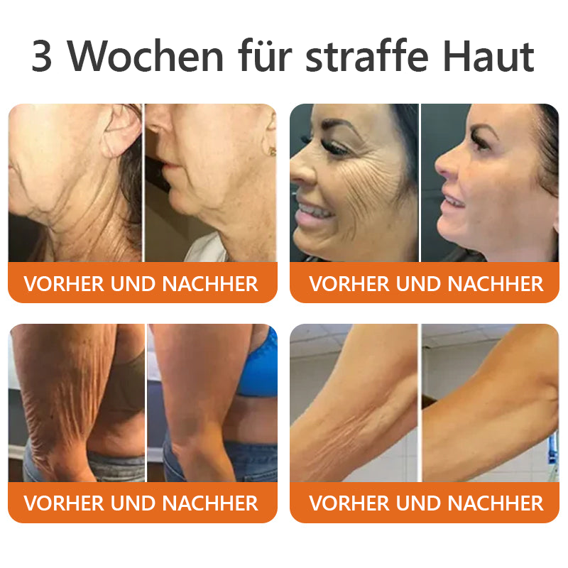 1+1 Gratis | Skinova™ Die natürliche Lösung für alltägliche Hautirritationen