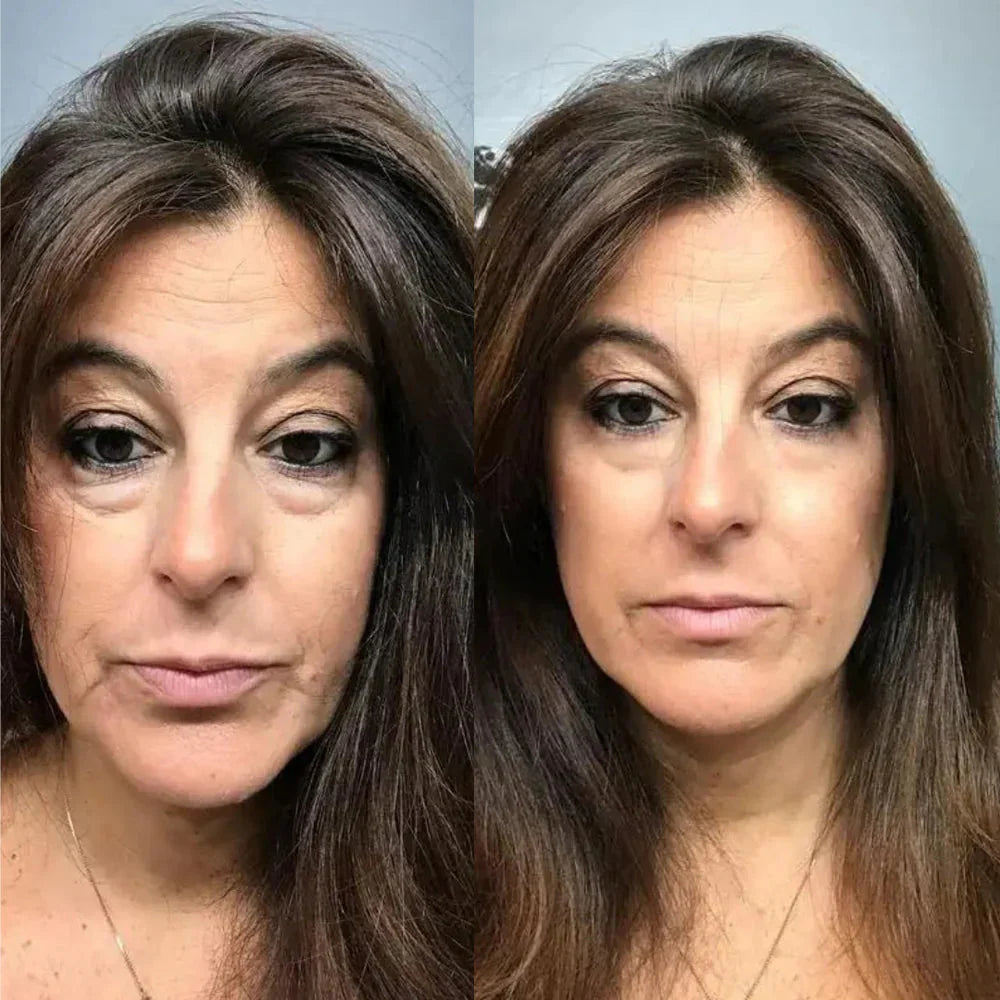 1+1 Gratis | Sofortige Lifting-Creme™ - Die Anti-Aging-Revolution für sofort straffere Haut!