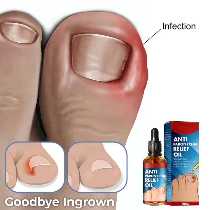 Anti-Paronychie Öl | Sofortige Linderung bei Eingewachsenen Zehennägeln | Fördert die Heilung | 100 % Natürlich