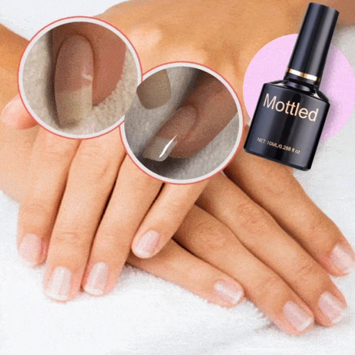 1+1 Gratis | Nagelreparatur Schutzgel™