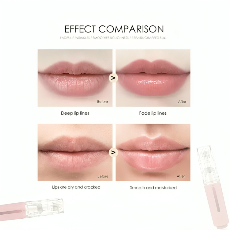 50% RABATT TEMPORÄR | LipLift™ | Erhalte volle & weiche Lippen!
