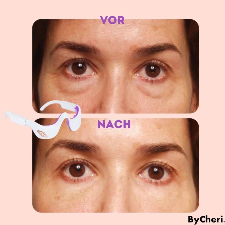 50% RABATT TEMPORÄR | RadianceEyes™ | Erleben Sie Augenmassage jederzeit und überall!
