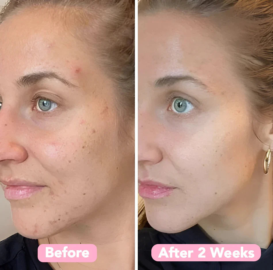 2+2 GRATIS | BrightEase™ – Enthülle strahlende, gleichmäßige Haut, die Blicke auf sich zieht