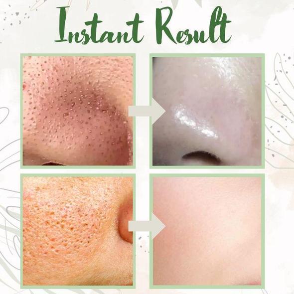 1+1 GRATIS | Poreless Deep Cleanse Mask Stick™ — Enthülle frische, strahlende Haut ohne Mitesser und Glanz