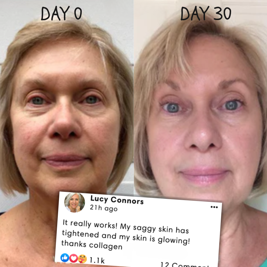 50% RABATT TEMPORÄR | RevitaMask™ | Genieße eine straffe & strahlende Haut!