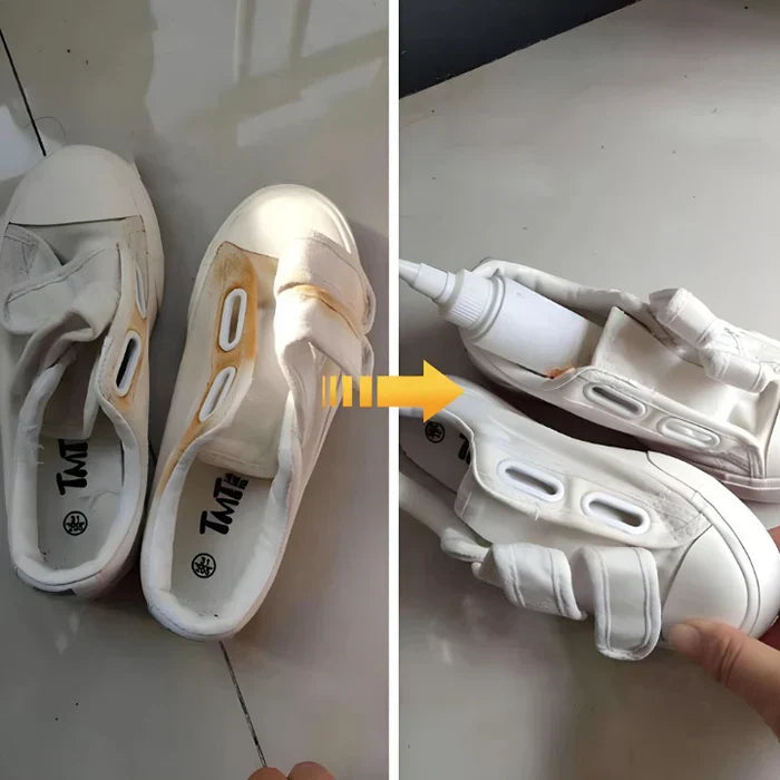 1+1 GRATIS | SpotBeGone™ — Flecken schnell und rückstandslos entfernen ohne Schäden